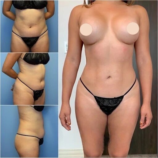 Best Doctors in Dubai in Personalized Body Contouring Procedures