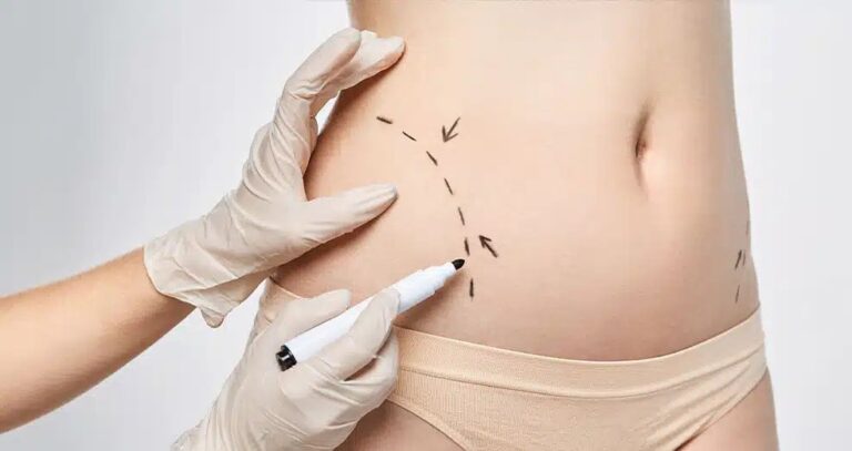 Combining Body Contouring with Skin Tightening in Dubai