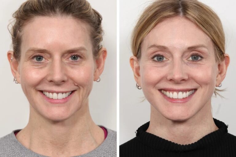 How the Best Doctors in dubai Ensure Long-Lasting Results